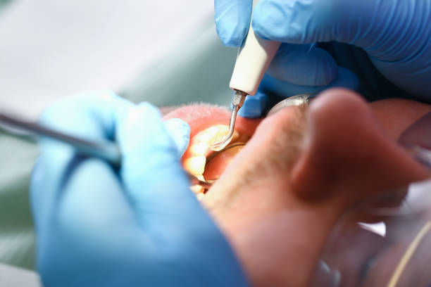 Best Emergency Dental Care for Trauma or Injury in Aurora, IN