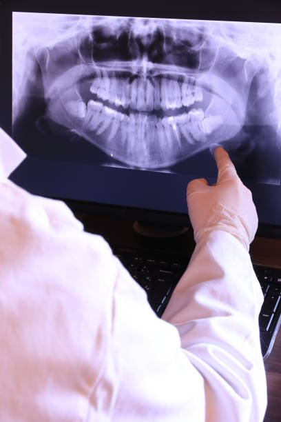 Best Walk-In Emergency Dentist in Aurora, IN