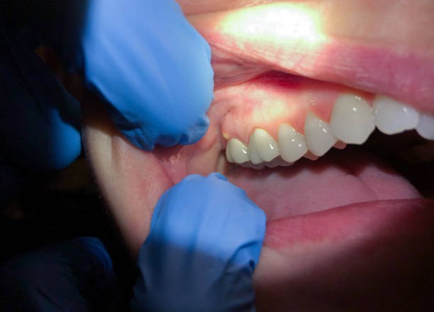 Best Same-Day Emergency Dentist in Aurora, IN